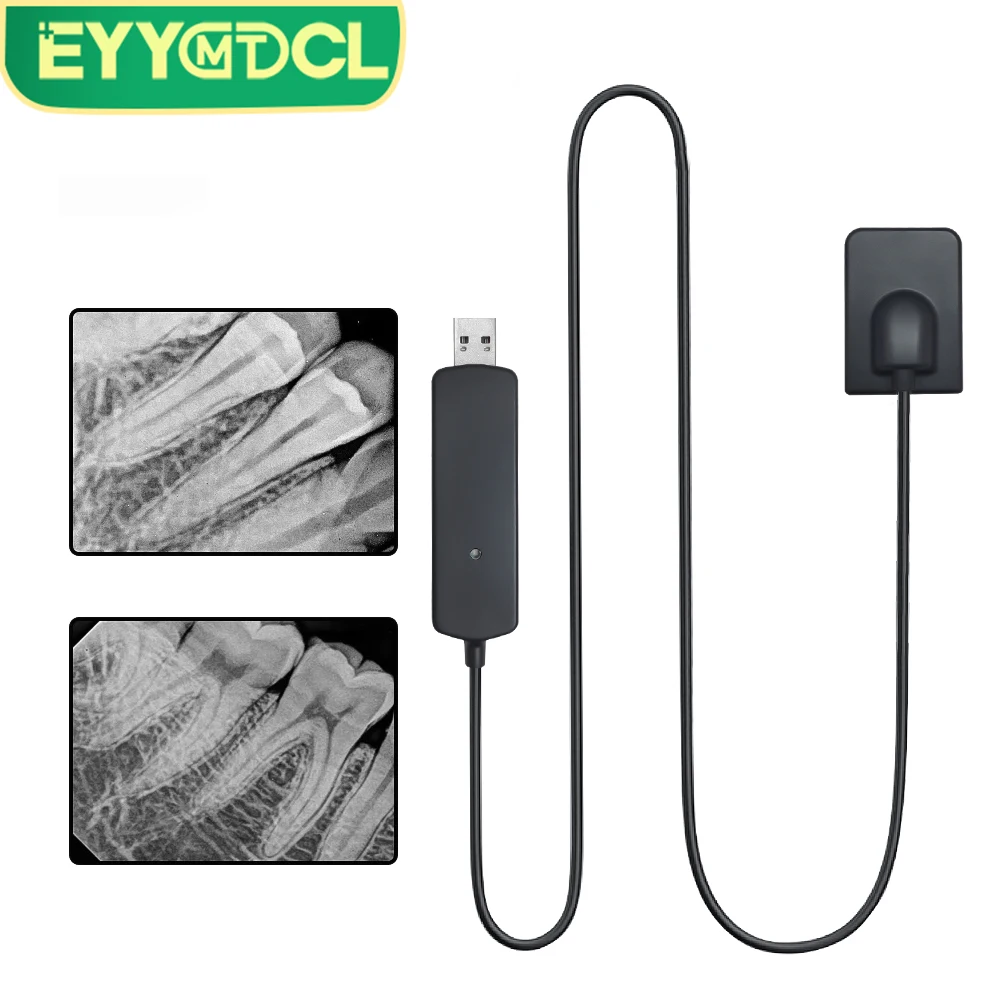 EYY Dental Digital RX Sensor with Software High-Frequency Intraoral HD Imaging System Radiovisografo Dental Oral X-ray Sensor