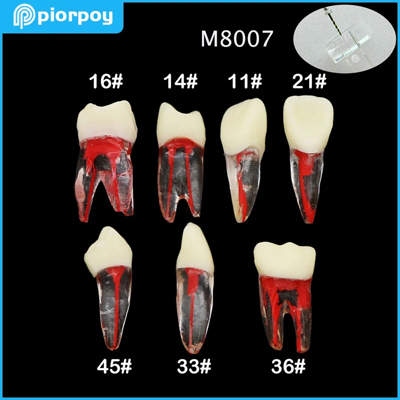 Dental Endo Training Tooth Root Canal Model Rotary Files RCT Endodontics Practice Block Pulp Cavity Dentistry Replace Resin