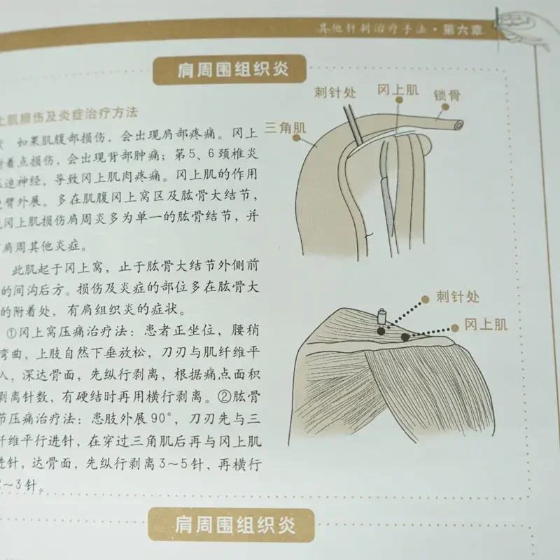 Imagem -05 - Gráfico Acupuntura Livro Medicina Chinesa Meridian Point Entry Point Sangue Pricking Tratamento Acupuntura Aprendizagem