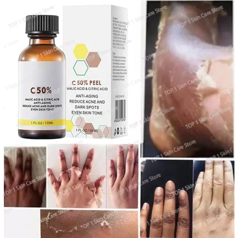 Yellow Bleaching Peeling Oil Dark Skin Remove Arm Knee Legs Melanin Body Brighten Scrub Exfoliating Dead Skin Care Whiten Serum