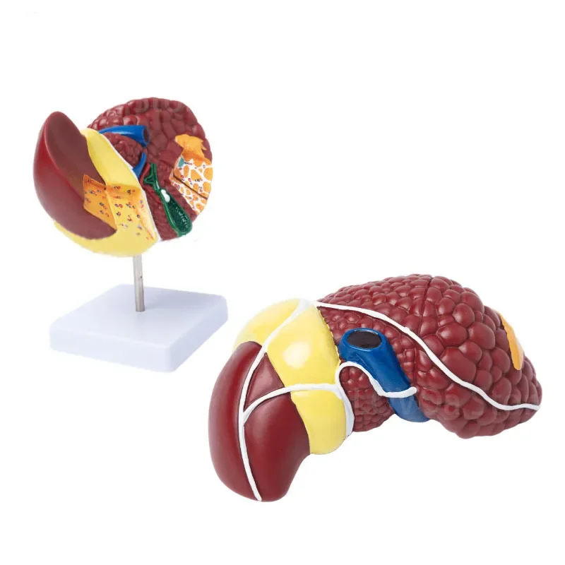 1:1 Human Pathological Liver Anatomical Model Display Of Digestive System Anatomy Teaching Model