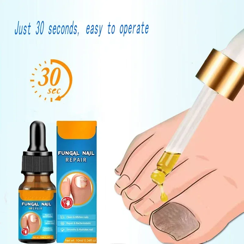 

Anti Infection Toe Fungus Hand Foot Removal Repair oil Nail fungus treatment serum removal and repair of nail fungi