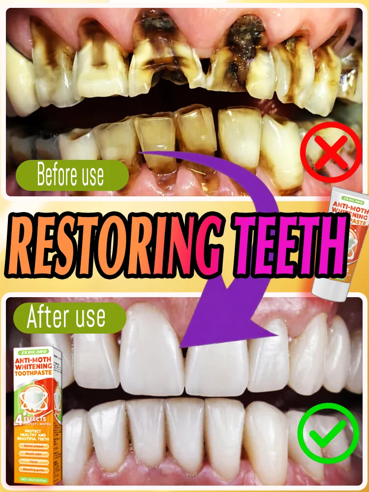 

Dᴇɴᴛᴀʟ ᴄᴀʀᴇ ᴀʟsᴏ ʀᴇᴏ̨ᴜɪʀᴇs "ᴘʀᴇᴄɪsɪᴏɴ sᴛʀɪᴋᴇ": ᴛᴀʀɢᴇᴛᴇᴅ sᴏʟᴜᴛɪᴏɴs ᴛᴏ ᴘʀᴏᴛ