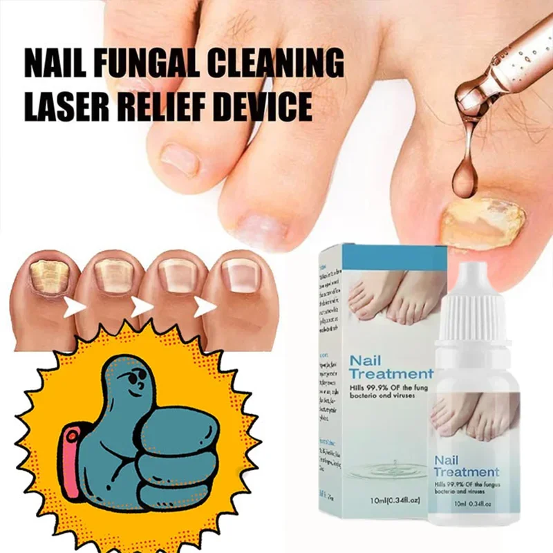 

Effective treatment of onychomycosis, removal of paronychia, anti oil fungus nail infection, care of toenail polish