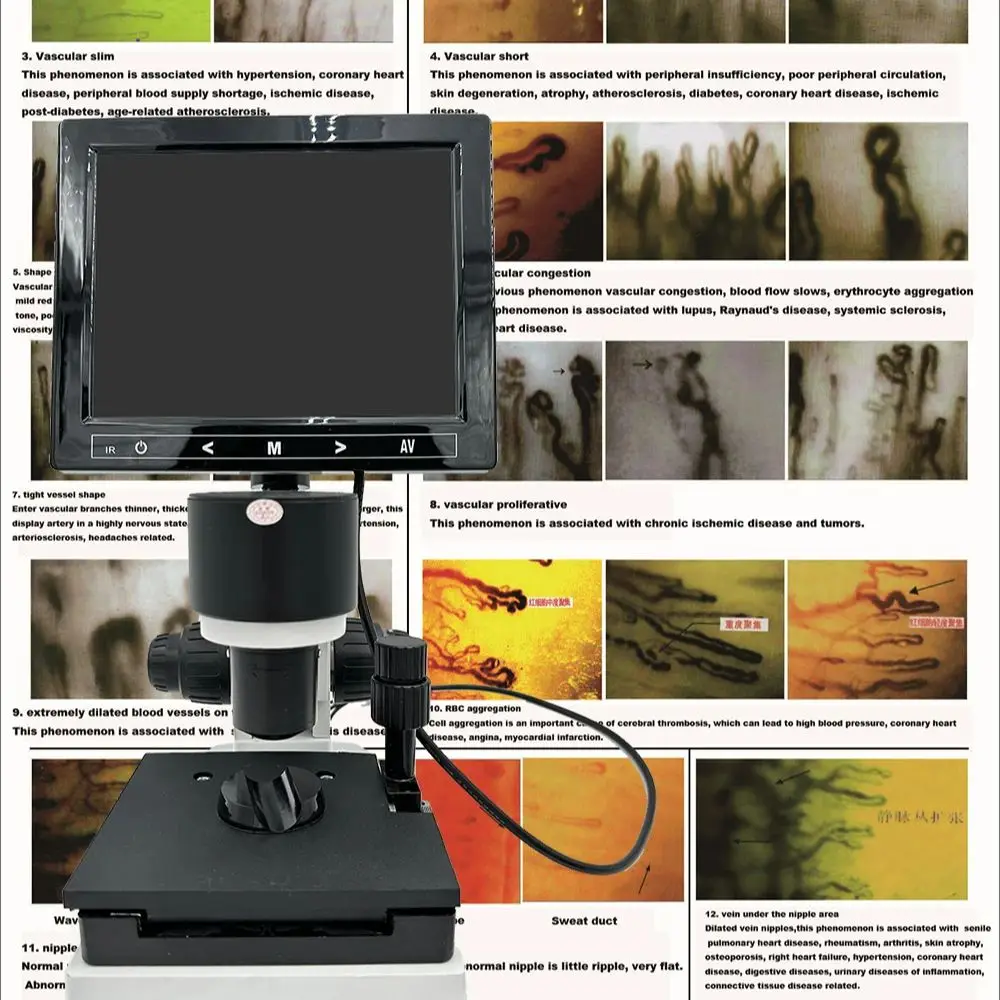 

LCD Professional blood cells Microscope trinocular biological Lab USB led trinocular microscope with digital camera