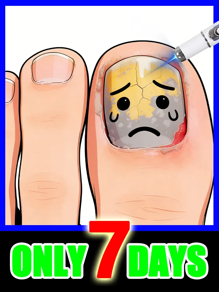 2025 Technology Changes Life - Anti-Fungal Technology - Say Goodbye to Onychomycosis with blue light,free shipping