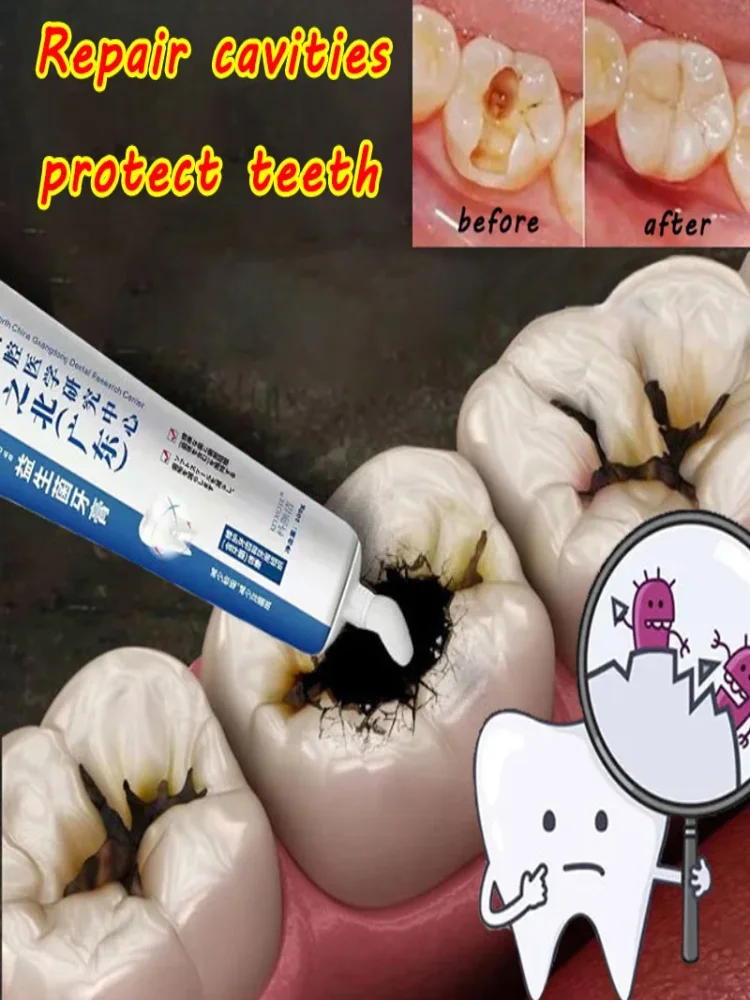 100g Quick Repair Of Cavities Caries Removal Of Plaque Stains Decay Whitening Yellowing Repair Teeth Teeth Whitening 2024 New