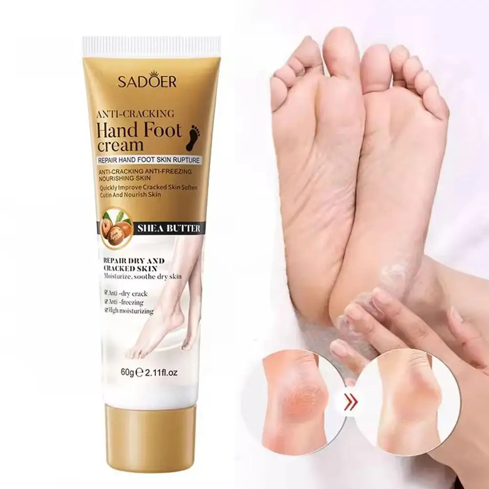 Crema antigrietas para pies y manos, 60g, reparación de talón agrietado, blanqueamiento de la piel, cuidado de los pies, hidratante, eliminación muerta, J8e5