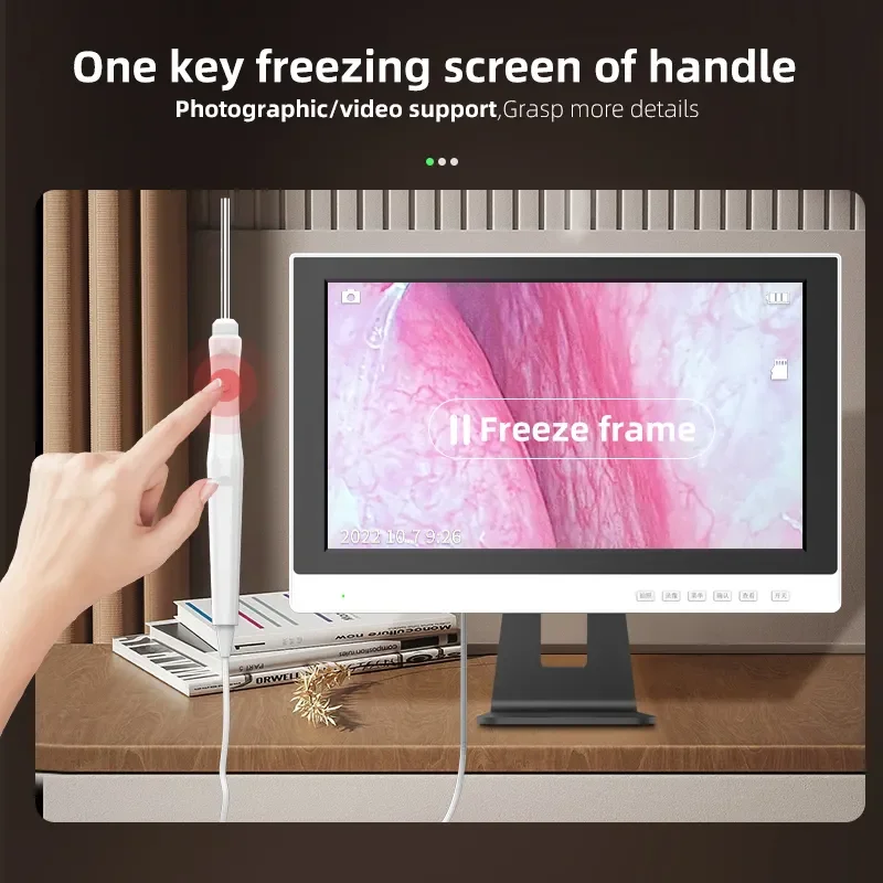 

Professional Visual Ear Endoscope 3.2mm/3.9mm Ear Cleaning Equipment 500W HD Pixels for Otolaryngology Inspection Tools with 32G