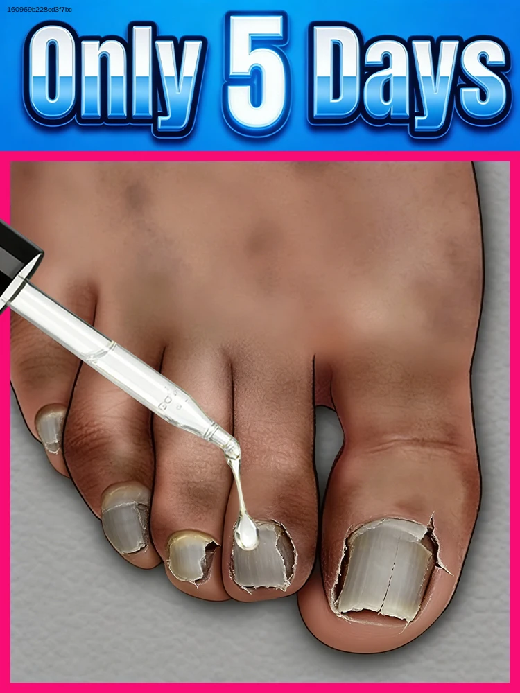 

Sᴀʏ ɢᴏᴏᴅʙʏᴇ ᴛᴏ ᴡᴇᴀᴋ ɴᴀɪʟs, sᴛʀᴇɴɢᴛʜᴇɴ ʟᴀʏᴇʀs ғᴏʀ ʟᴏɴɢ-ʟᴀsᴛɪɴɢ ᴠɪᴛᴀʟɪᴛʏ.