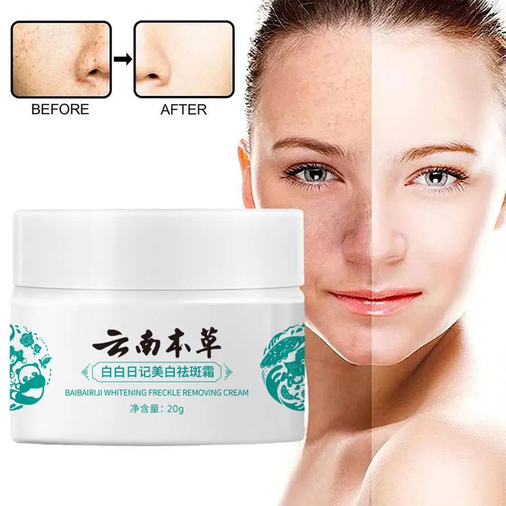 

20g Powerful Yunnan Herb Whitening Freckle Cream Remove Spots Spots Dark Care Acne Face Skin Moisturizing Face Beauty