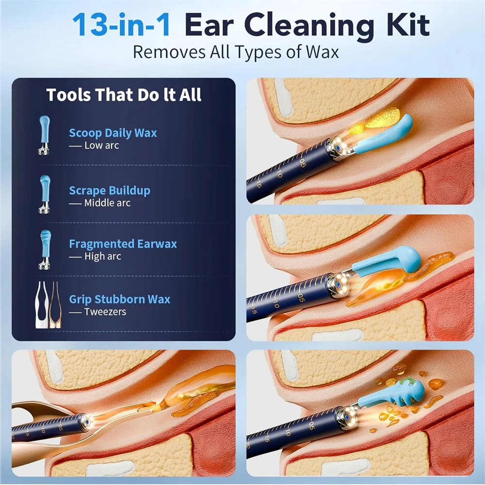 Thumbnail 2 - #30 Cheapest Wax Removal Kits Deals You Can Get