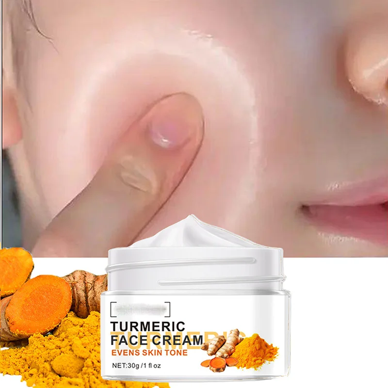 

Отбеливающий крем для лица с куркумой, удаление морщин, осветление тонких линий, делает кожу, более молодежный, увлажняющий уход за лицом