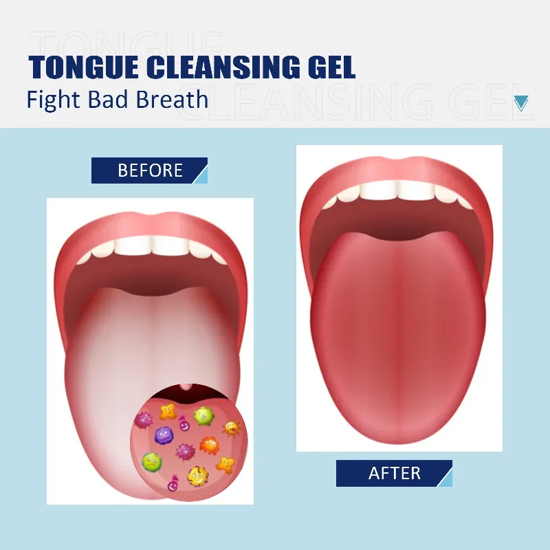 50g Tongue Cleansing Gel With Tongue Brush Clean Oral Care Remove Odour Fresh Breath Tongue Scraper