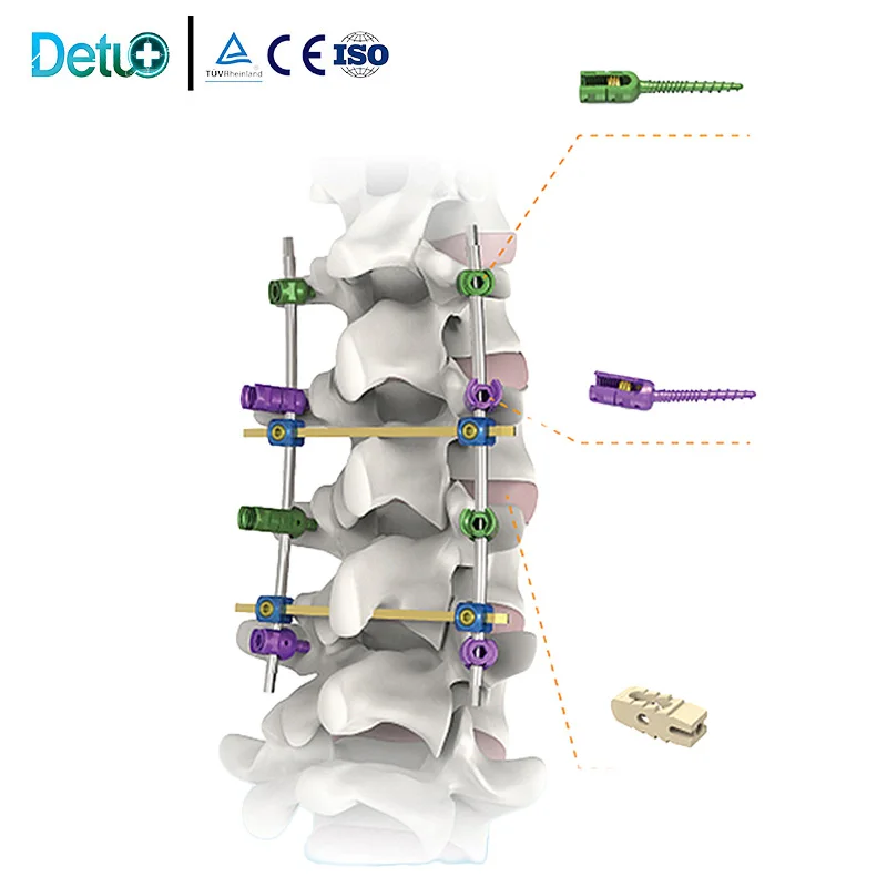 Orthopedic umbar PEEK Cage High Quality In Stock Factory Direct Supply CE Certified Sizes 8-14 1 Year Warranty
