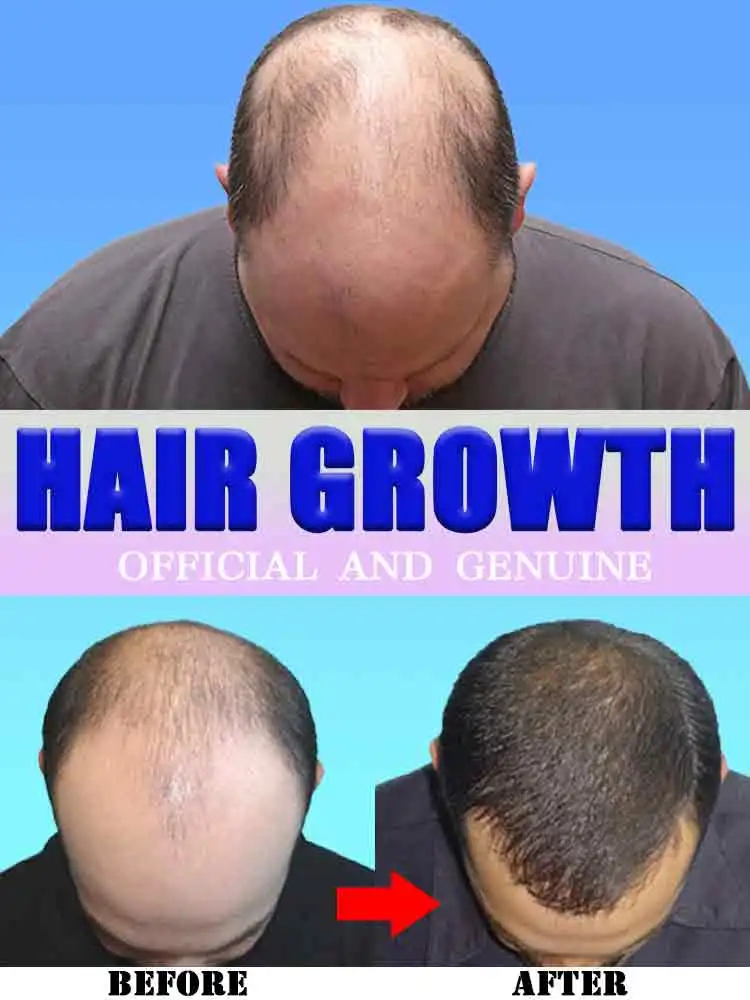 Rapid Hair Growth Conditioning Serum Treat Hairline Repair Damaged Hair Prevent Hair Loss Grow Hair Rapidly