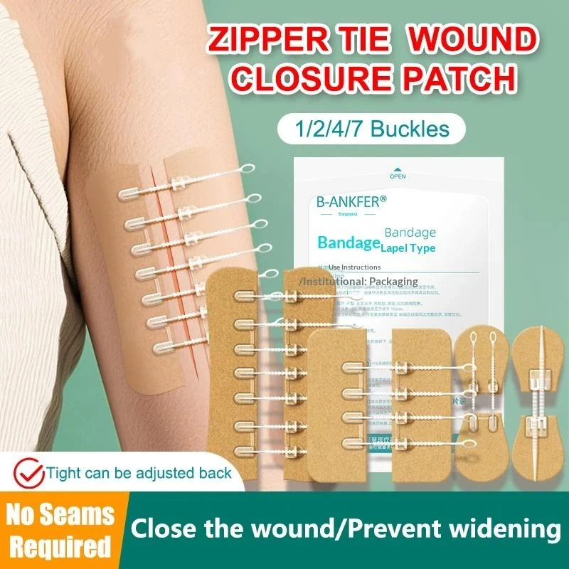 Zipper Tie Wound Closure Patch Hemostatic Patch Wound Fast Without Suture Zipper Outdoor Band-Aid Portable Quick Clot Wound