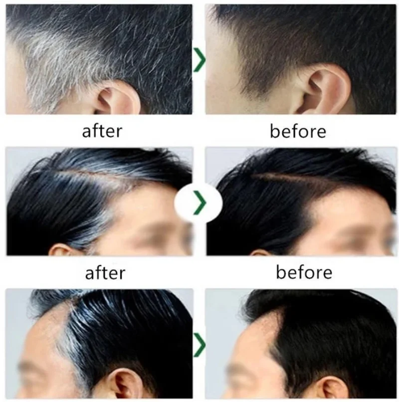 Gray White Hair Reduce Serum Cover White Hair To Black Natural Color Fade Spray Anti Loss Hair Restore Healthy Hair Care