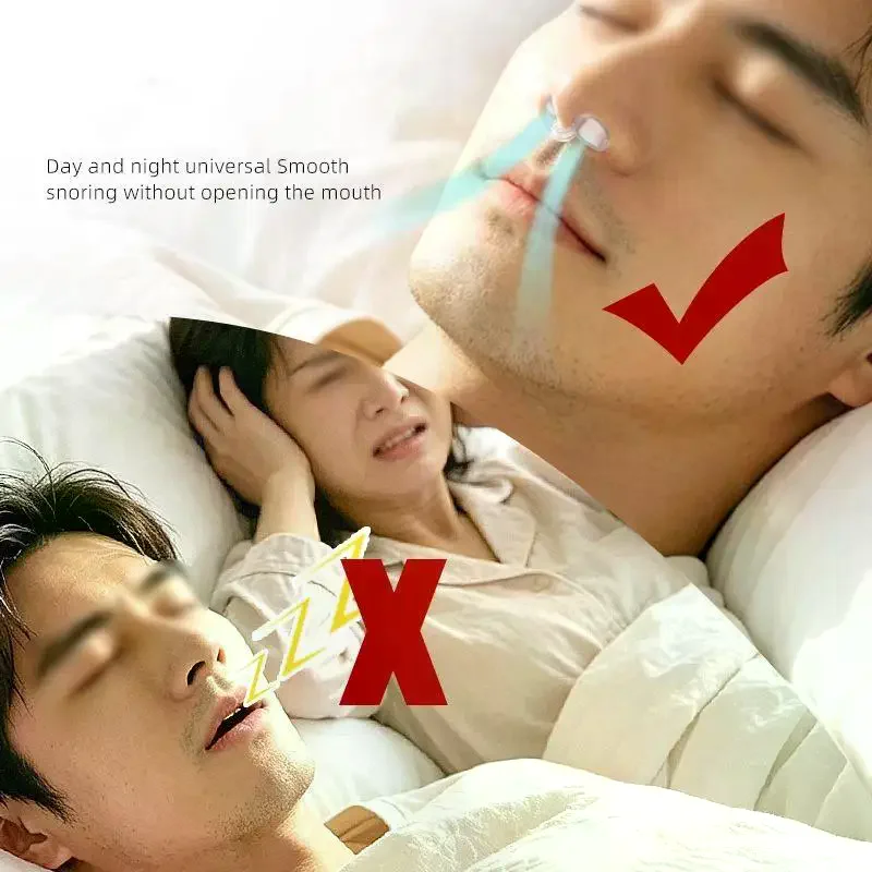 1/2Pcs Anti Snoring Devices Professional Nose Vents Nasal Dilators For Better Sleep Breathe Easy