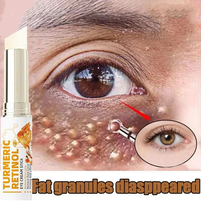 Turmeric Eye Cream Stick Removal Fat Granules Brightening Eyes Anti-puffiness Firming Cream Anti Inflammatory Fade Fine Line