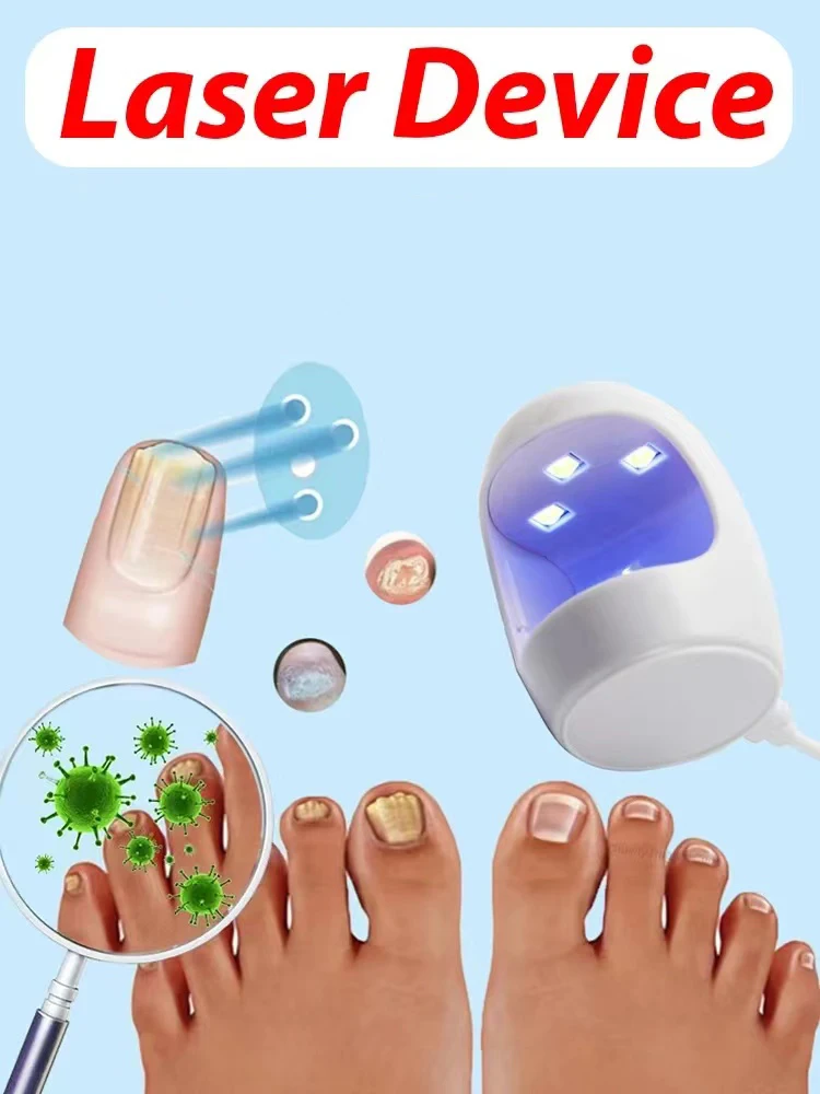 Laser solves all nail problems