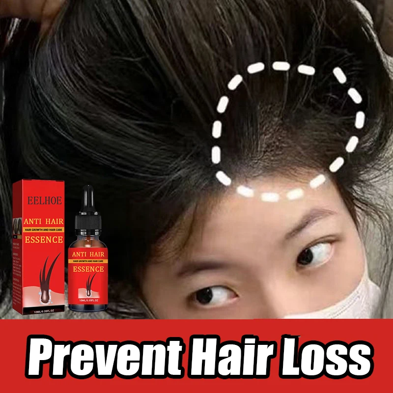 

Hairs Nourishing Repair Hereditary Postpartum Seborrheic Anti Loss Care for Men Women Scalp Cares Baldness Hairs Care Serum