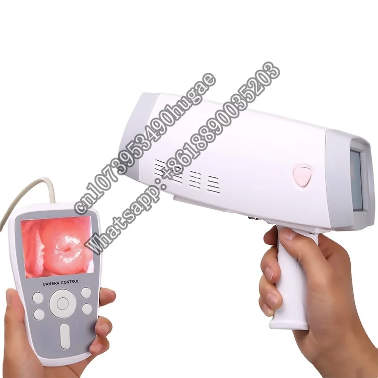 

MY-F005 Medical Portable handheld electronic Video Colposcope for gynecology