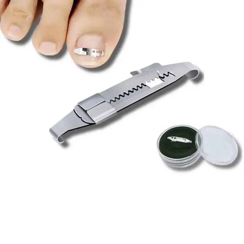 1pcs Ingrown Toenail Correction Brace Kit Professional Toe Nail Care Pedicure Manicure Clipper Fixer Recover Corr