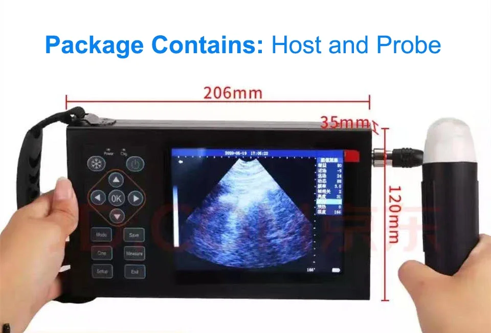 RS Custom Animal B Ultrasound Machine Veterinary Medical Equipment Probe Preheating Pregnancy Test etc