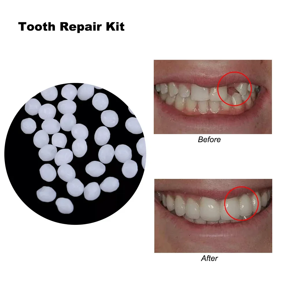 Falso dentes falsos enchimento, reparo do dente, sorriso snap em folheados, dentaduras caso, colar grânulos adesivos, cosméticos, 4 cores