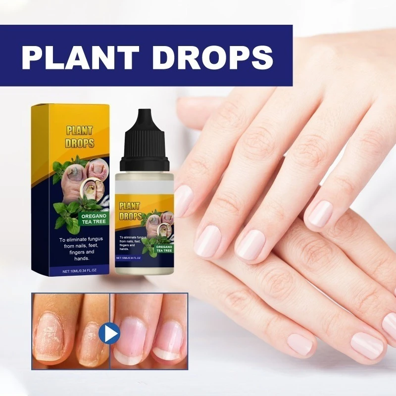10ml reparación de hongos en las uñas líquido suave cuidado de las uñas hidratante para manos y pies ilumina las gotas de las uñas