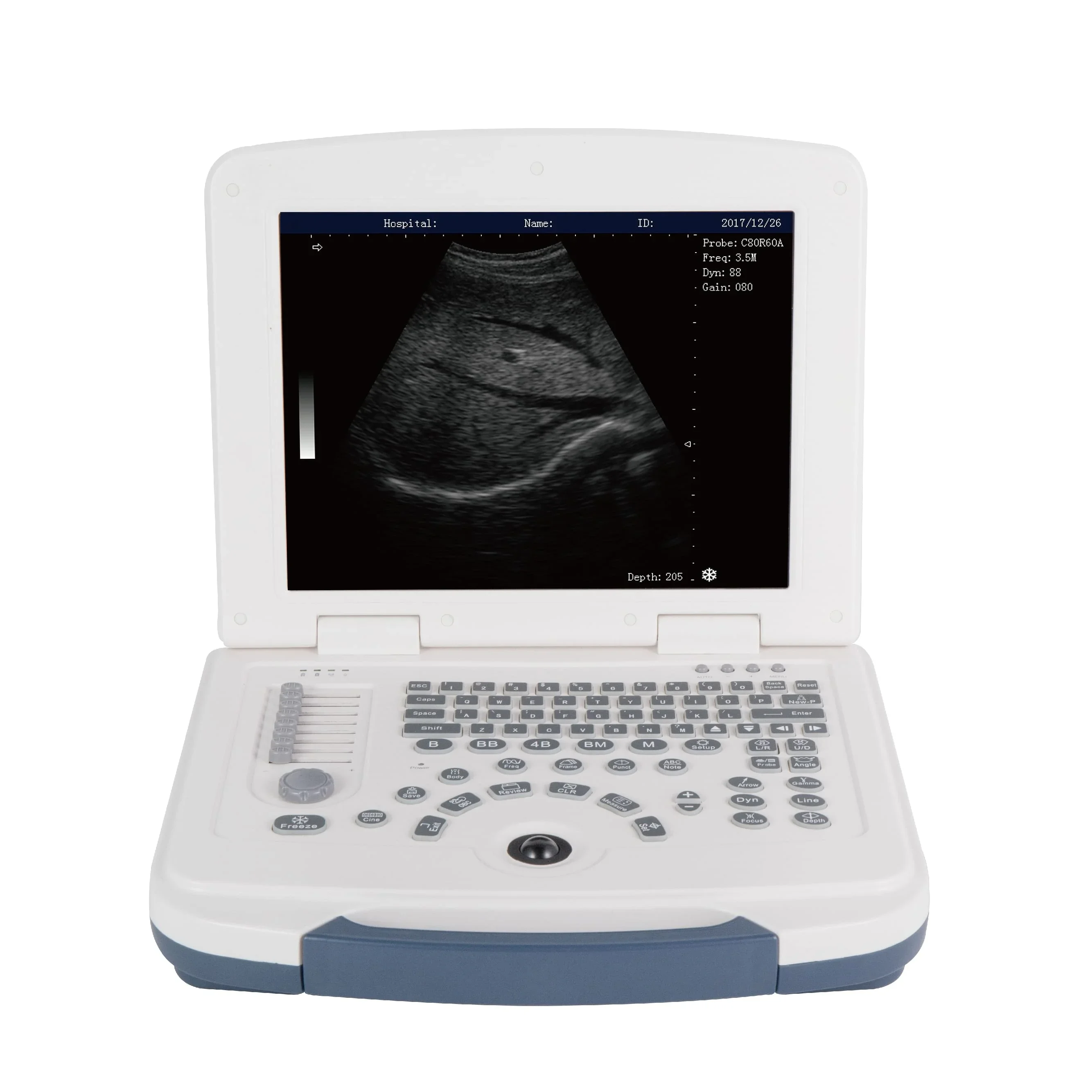 Portable Ultrasound Baby Scanner/Early Ultrasound/ human