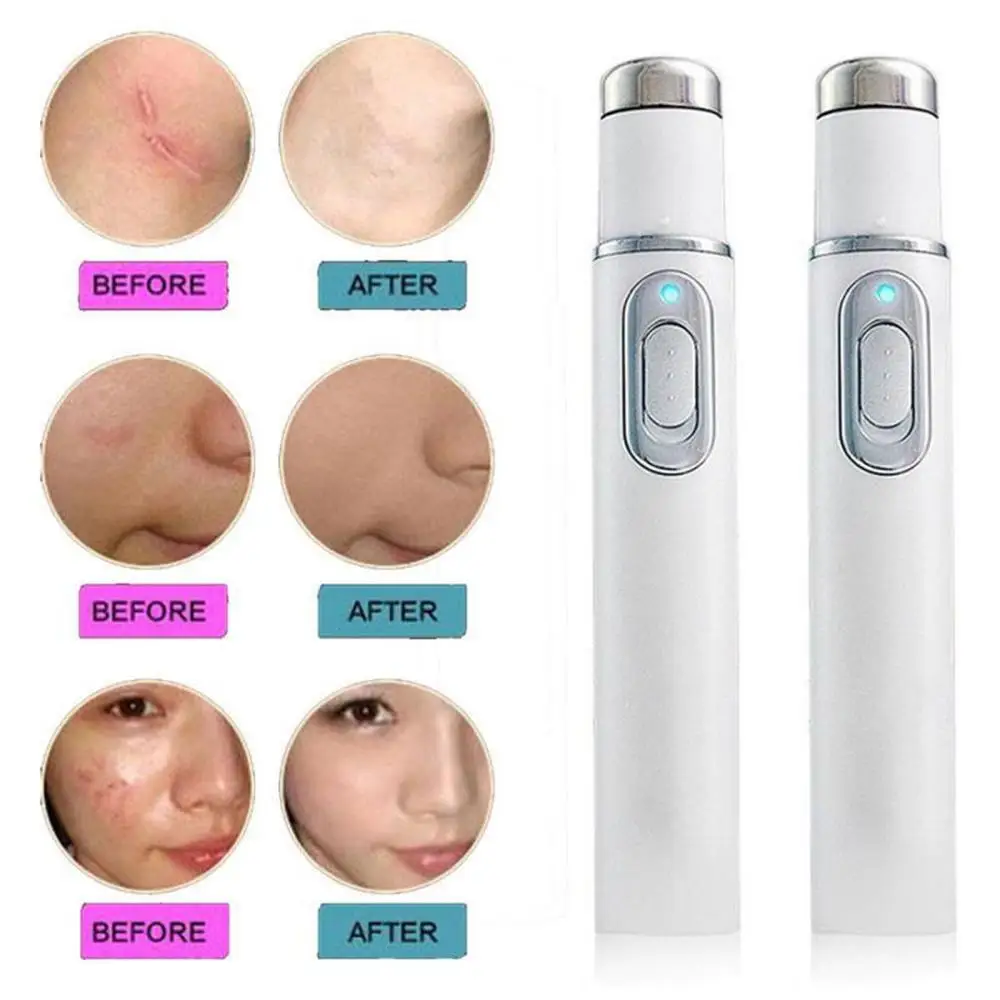 Eye Massage Stick Current 0.6a แรงดันไฟฟ้า Dc1.5v บรรเทาความเมื่อยล้าของดวงตาแบบพกพาและสะดวกลดความหมองคล้ํา Eye Spa เครื่องมือ