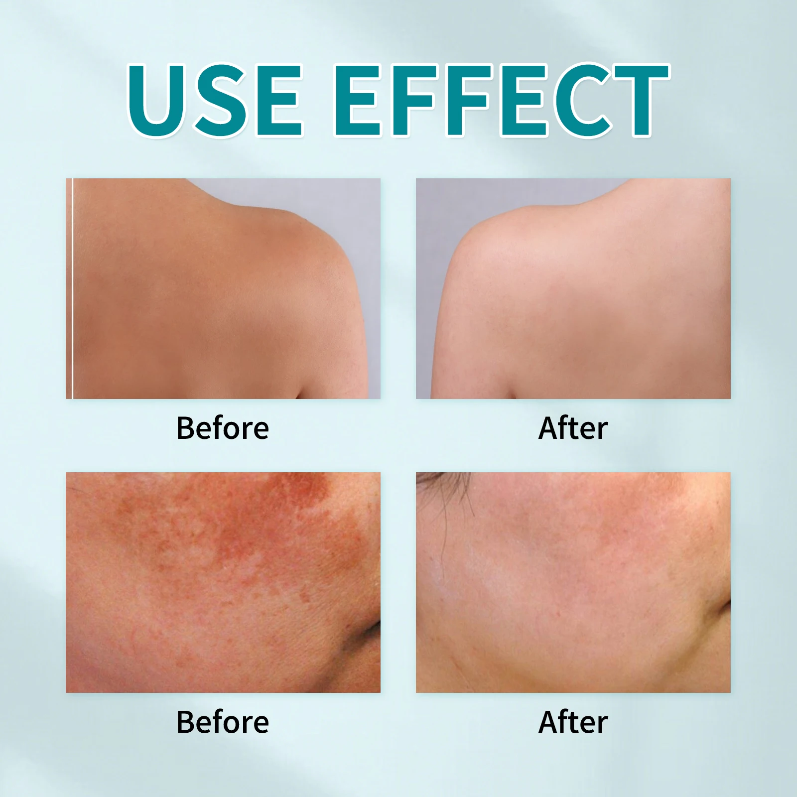 عصا واقية من الشمس SPF50+ PA+++ 20 جرام مقاومة للماء للحماية من الشمس، مع كينتيللا للتهدئة والترطيب، للوجه والجسم #6