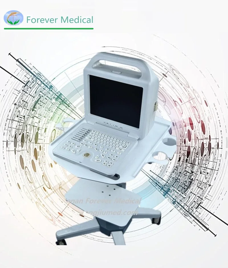 Full Digital Ultrasound Medical Machine Black White Laptop Ultrasound Scanner Portable Ultrasonic Equipment