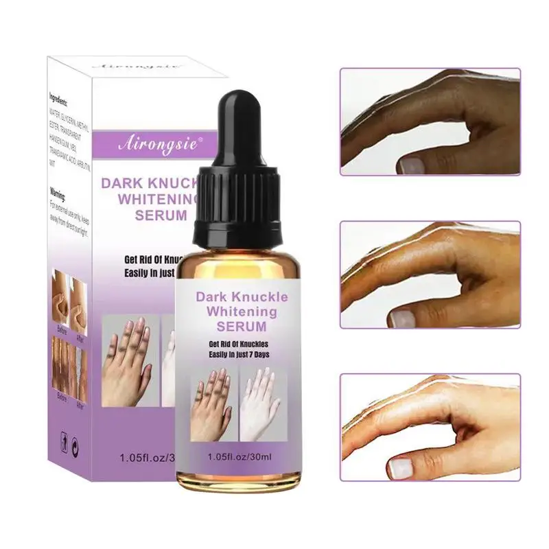 30ml Hand Whiten Essence Exfoliates And Restores Hand Knuckle Darkening Essence Skin Care For Reducing Unbalanced Pigmentation