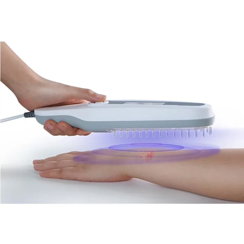 Factory produce CE approved uvb light therapy for vitiligo treatment