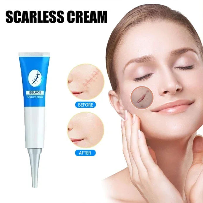 

Acne Scar Removal Repair Burn Surgical Scars Stretch Marks Promote Cell Regeneration Repair Treatment Body Skin Care09