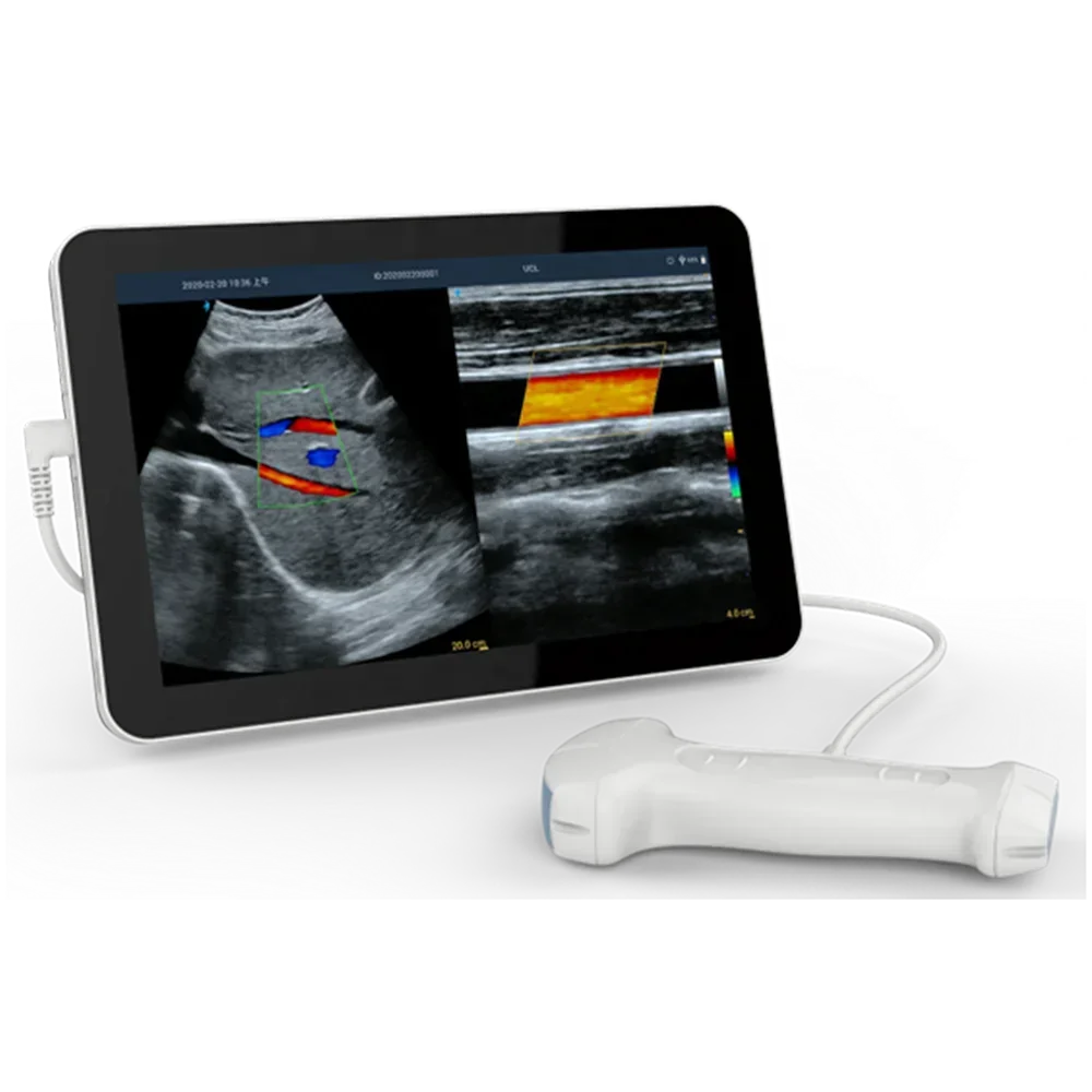 Amain Magiq Mcucl Fabricage Prijs Van Zwangerschap Ultrasound Machine Lineaire & Bolle Dual Probe Android Ultrasound Scanner