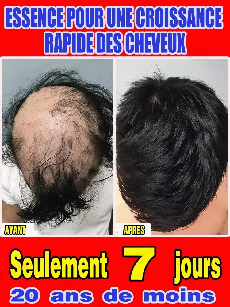 ᑫᵘᵃˡⁱᵗʸ ᶜʰᵒⁱᶜᵉ⸴ ᵒᵖᵉⁿⁱⁿᵍ ᵗʰᵉ ʳᵒᵃᵈ ᵗᵒ ʰᵃⁱʳ ᵍʳᵒʷᵗʰ ᶠᵒʳ ʸᵒᵘ ᵗᵒ ˢᵃʸ ᵍᵒᵒᵈᵇʸᵉ ᵗᵒ ᵇᵃˡᵈⁿᵉˢˢ