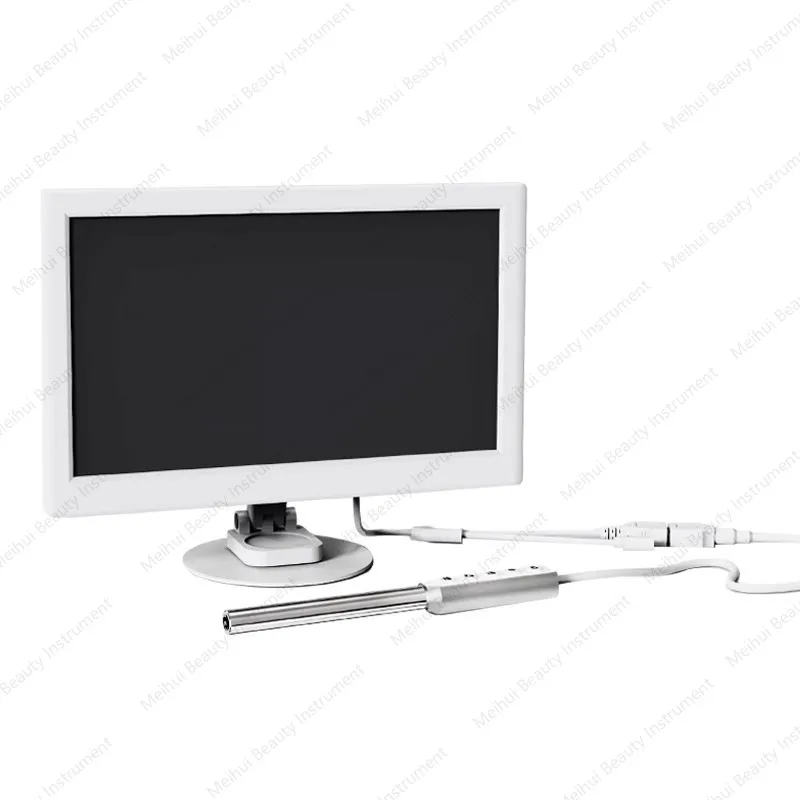 منظار أمراض النساء، المنظار المهبلي الإلكتروني، كاشف عنق الرحم عالي الوضوح، كاشف خاص #1