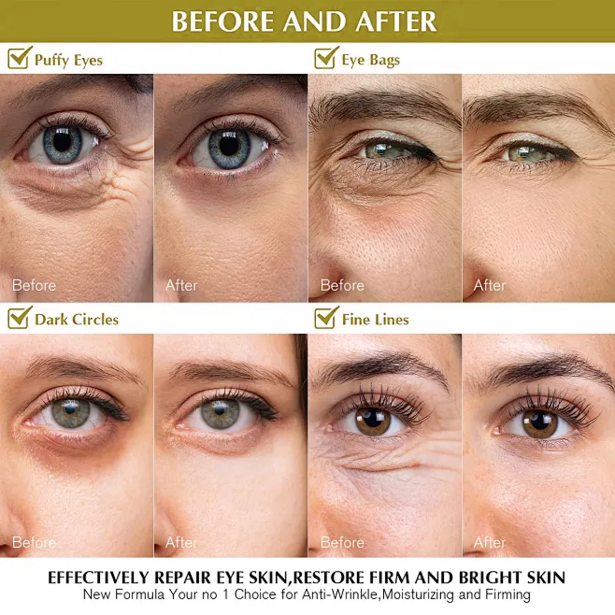 كريم العين EXE CREAM 010 مع الريتينول وحمض الهيالورونيك - مرطب وتنعيم وعلاج عين مضاد للشيخوخة #3