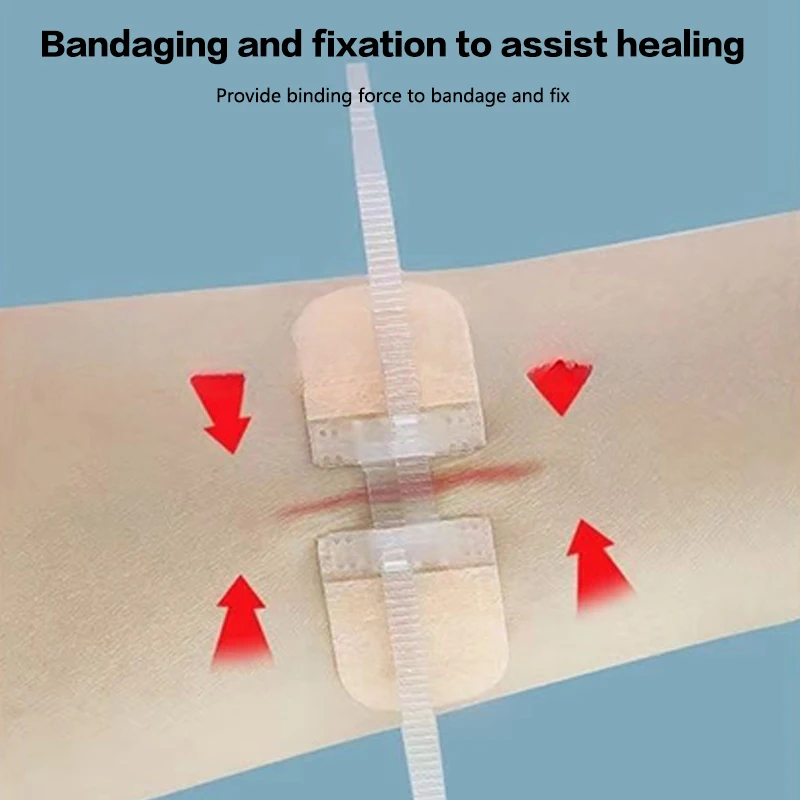 Ferida cuidados bandagem adesiva, 1 parte, bandagem com zíper, gesso médico, primeiros socorros, hemostático, para uso ao ar livre