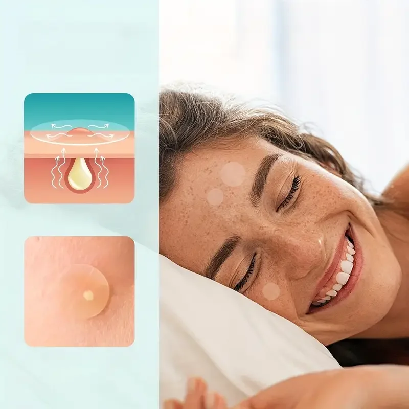 288/360 unidades, adesivos para acne - dois pedaços de água colóide para cobertura de acne para dia e noite, com ácido hialurônico e chá tre