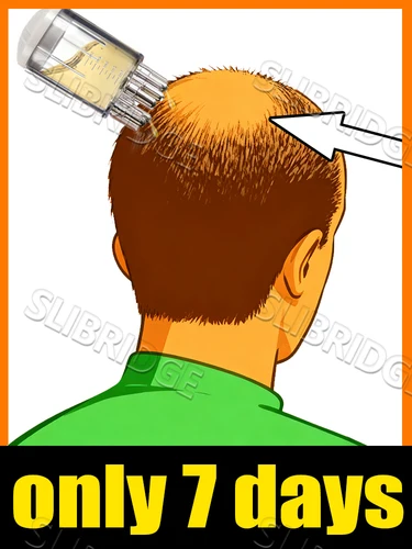 Generación-2, aplicador de cuero cabelludo, peine líquido, mini peine de masaje portátil, masajeador guía de líquido, herramienta para el cuidado del cuero cabelludo antipérdida de cabello, 7 días