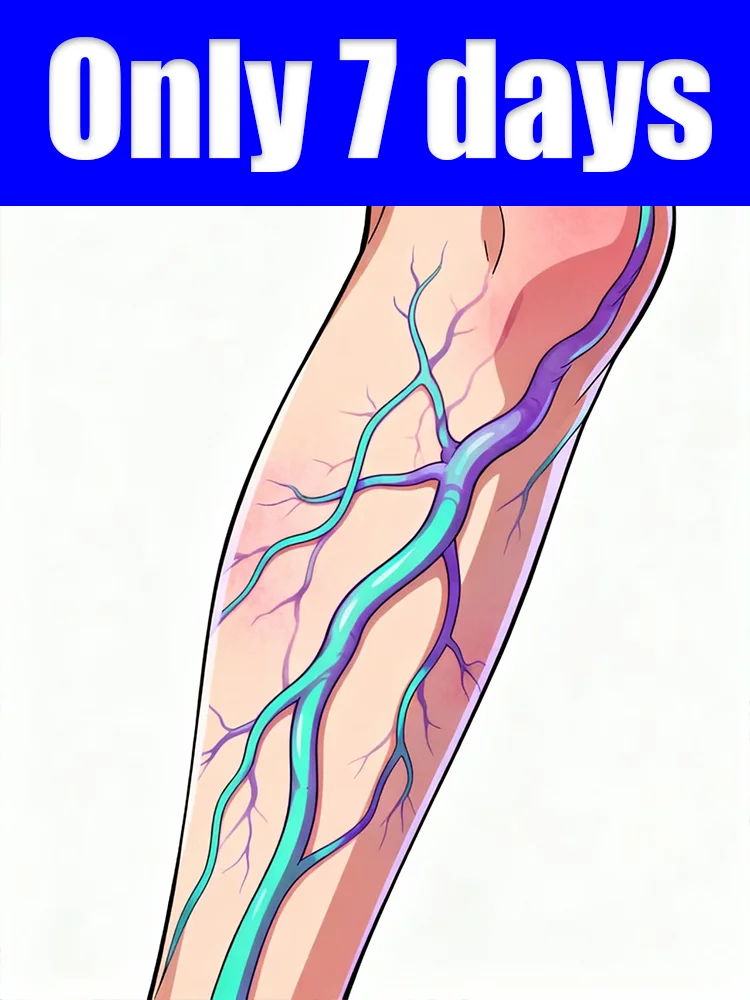 

Chronic venous discomfort problem at its root