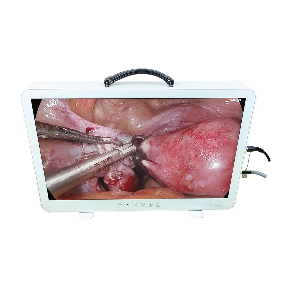 27 Inch FHD Portable Telepack Endoscope Camera for Hysteroscopy Laparoscopy Urology