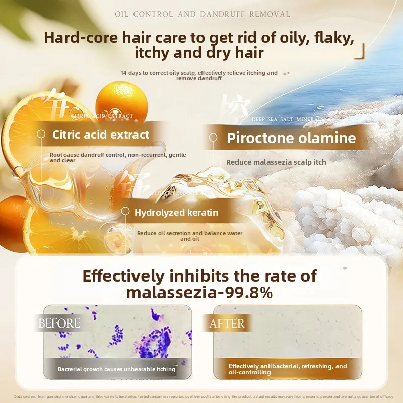 Oil control fluffy shampoo dan - Perfume Fragrance Shampoo recensione e prezzo