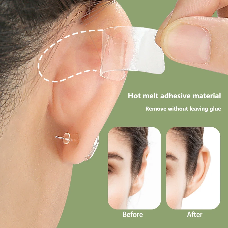 4/6Pcs Elf Ear Sticker Stereotype Correction Ear Supporter Wind Ear Elf Ear Sticker Standing Ear Support Invisible Correction