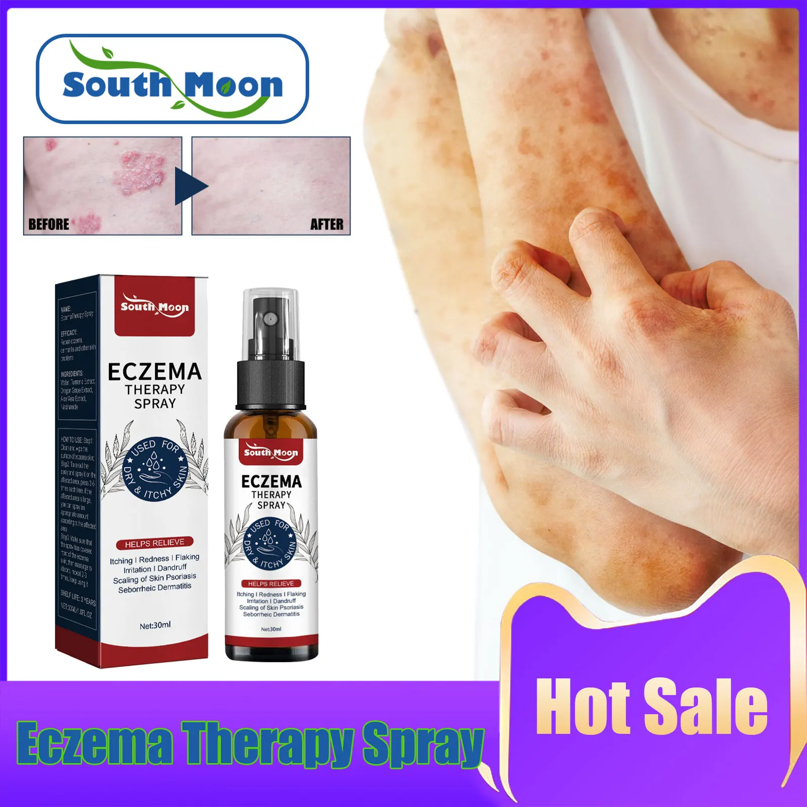 

Psoriasis Treatment Spray Relieve Rash Desquamation Dermatitis Anti Urticaria Itching Relief Antibacterial Eczema Care Spray